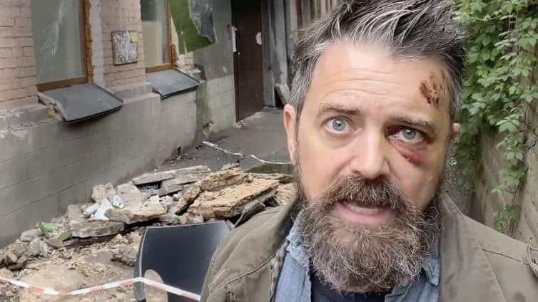 У Києві балкон впав на американського режисера: причина — не війна, а бездіяльність У Києві балкон впав на американського режисера: причина — не війна, а бездіяльність