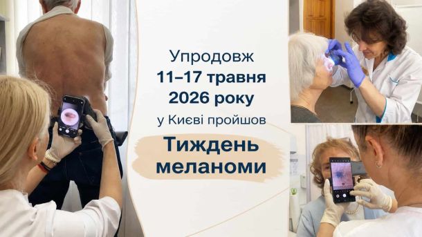 Київміськбуд хоче забудувати схили Пейзажної алеї: 0,86 га в охоронній зоні Лікарі-дерматовенерологи оглядають пацієнтів під час безоплатного Тижня меланоми у Київській міській клінічній лікарні 4, 11–17 травня 2026 року