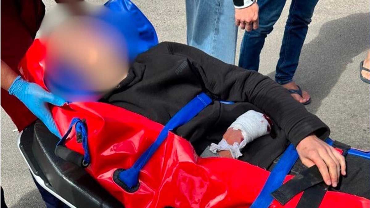 ДТП у Переяславі: 17-річний мотоцикліст зазнав ампутації пальців ДТП у Переяславі: 17-річний мотоцикліст зазнав ампутації пальців