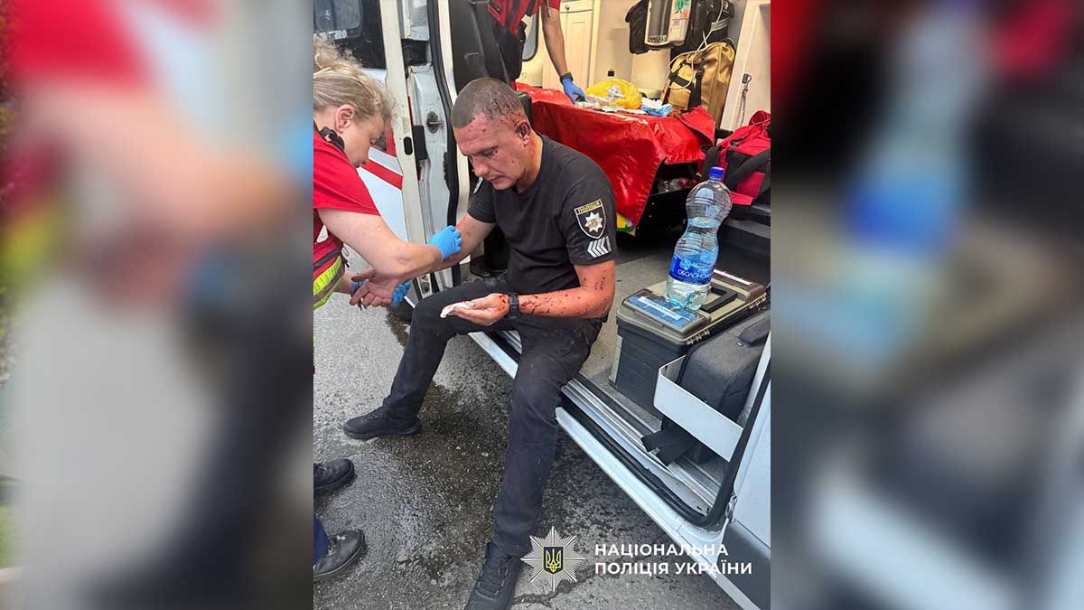 Троє київських поліцейських, поранених під час ракетного удару 31 липня, досі в лікарні Троє київських поліцейських, поранених під час ракетного удару 31 липня, досі в лікарні