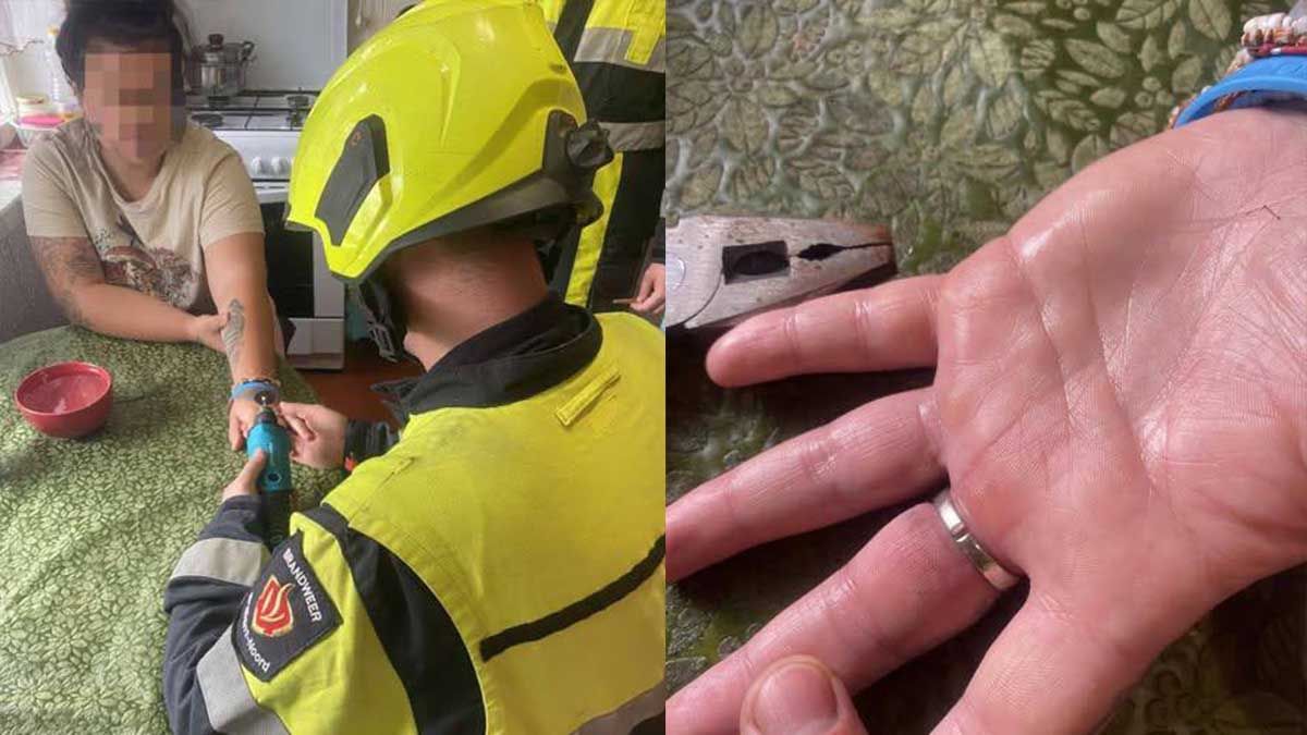 На Оболоні рятувальники зняли каблучку з пальця жінки за допомогою гравера На Оболоні рятувальники зняли каблучку з пальця жінки за допомогою гравера