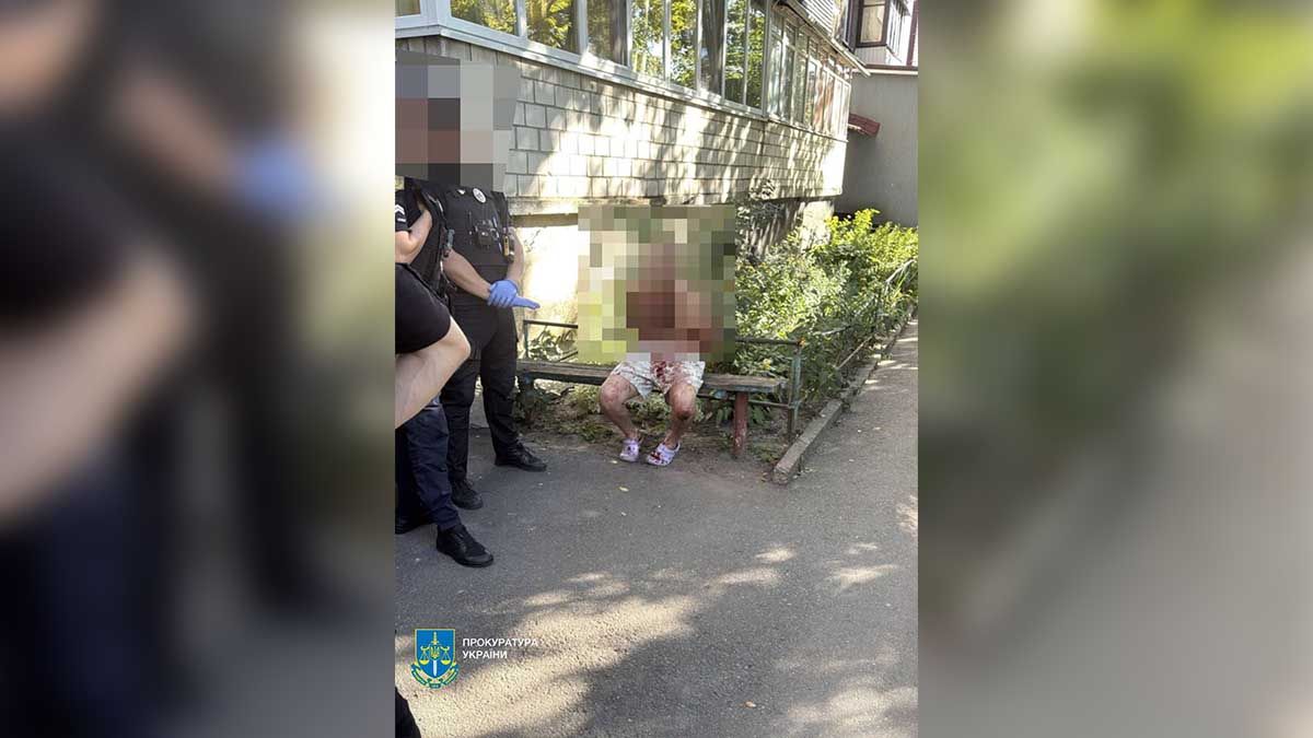 У Білій Церкві оголошено підозру у вбивстві 17-річної дівчини Затворене фото з поліцейськими біля чоловіка, який сидить на лавці, на вулиці Києва, ситуація на місці події, ілюстрація новинний випадок або інцидент у місті.