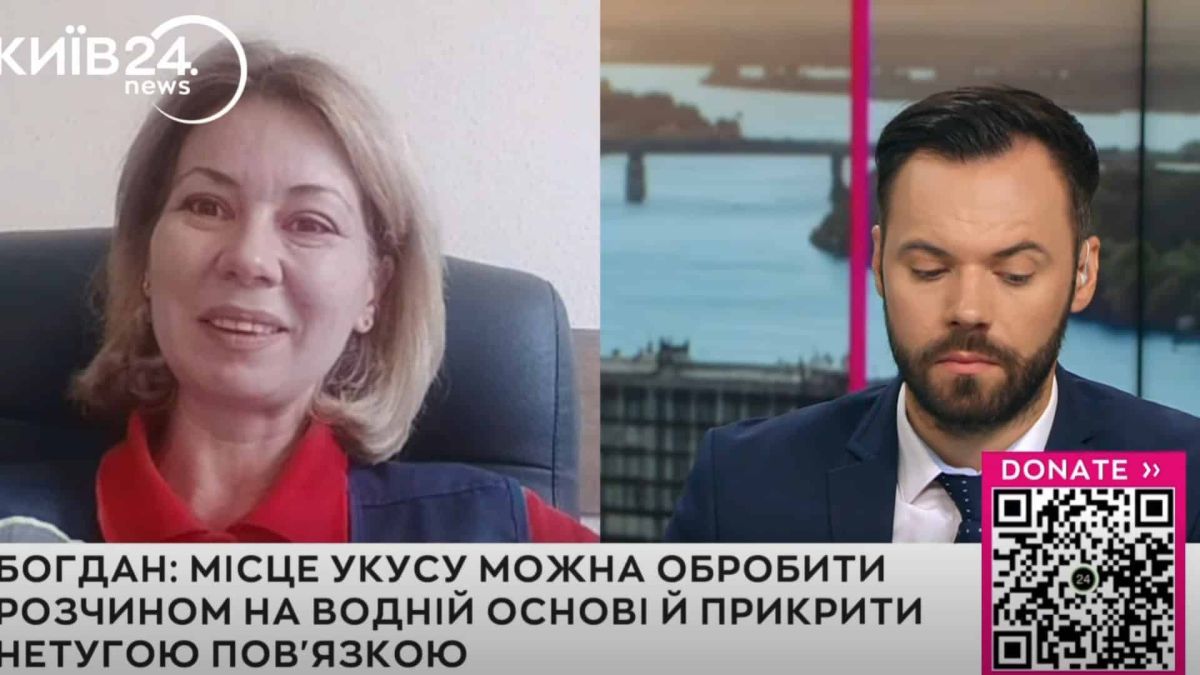 В Охматдиті врятували дворічного хлопчика після укусу змії Завідувачка Центру екстреної медичної допомоги Ольга Богдан розповідає про першу допомогу при укусі змії в етері телеканалу Київ 24