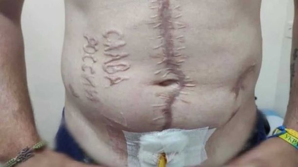 90% українських полонених зазнають катувань у РФ — свідчення та факти 90% українських полонених зазнають катувань у РФ — свідчення та факти