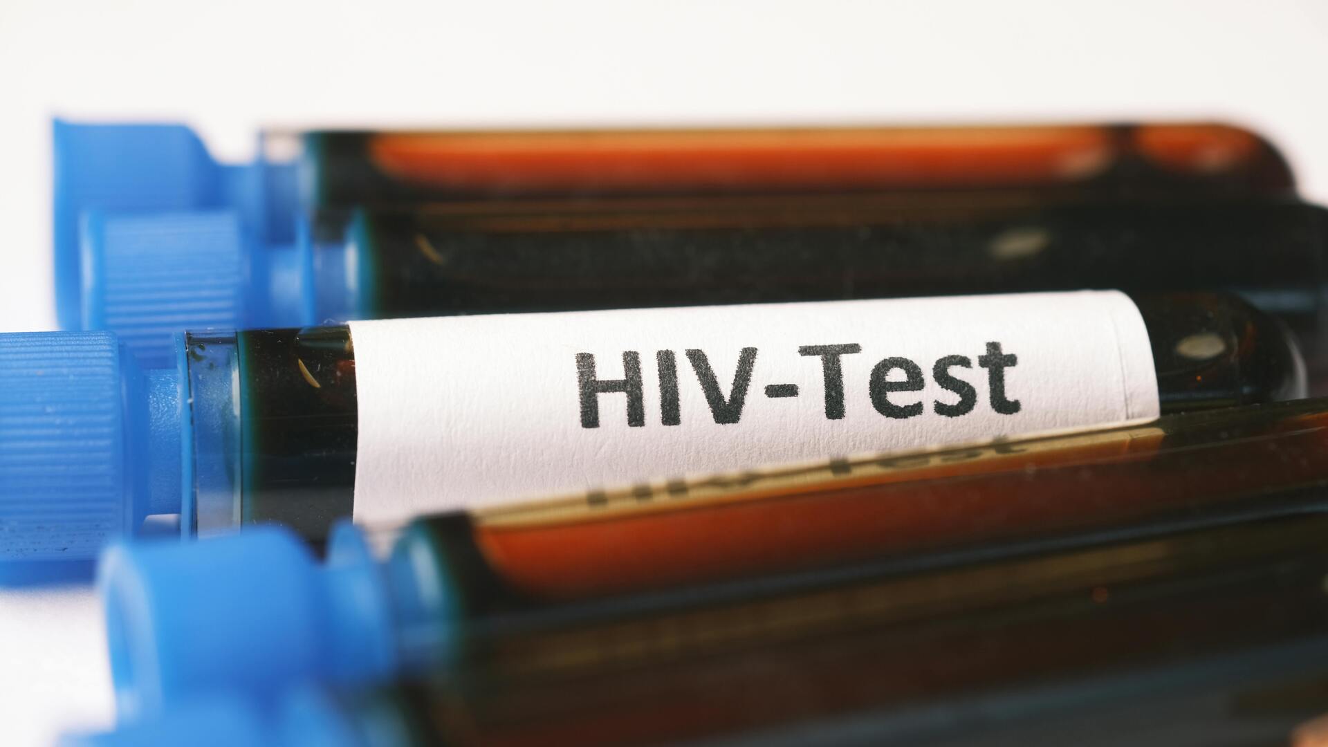 Пробірка з кров'ю з написом HIV-Test