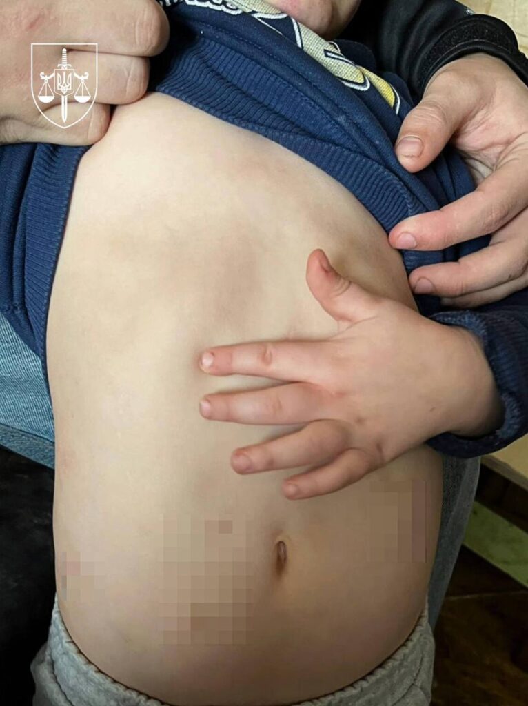 На Київщині поліція затримала 27-річного чоловіка, який знущався з двох малолітніх дітей
