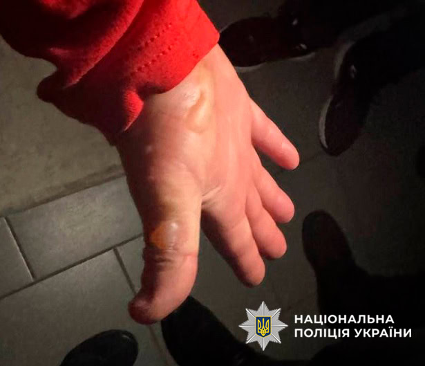 Киянин підпалив Hyundai через ревнощі