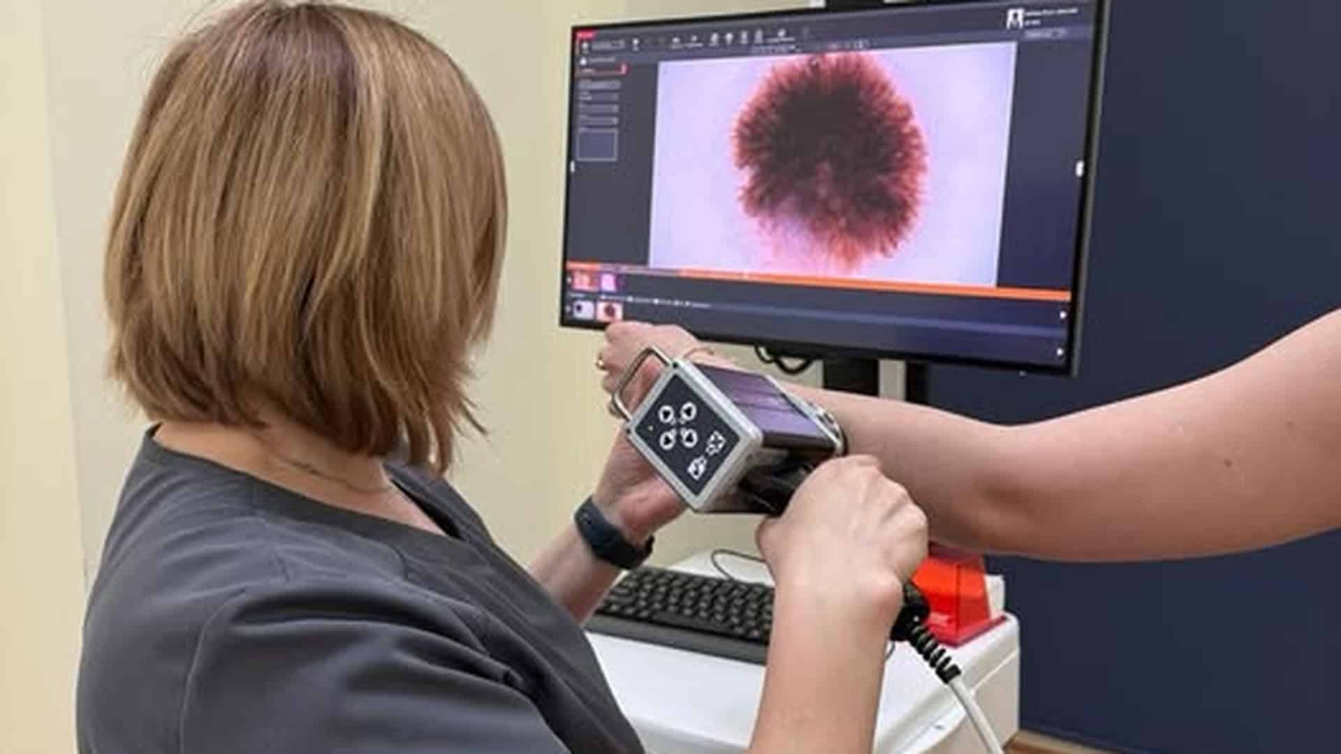 Лікар проводить дерматоскопічне обстеження родимки пацієнта — діагностика меланоми та раку шкіри у Києві