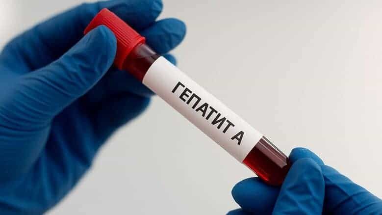 У Києві спалах гепатиту A: понад 70 випадків, серед них 33 — у дітей