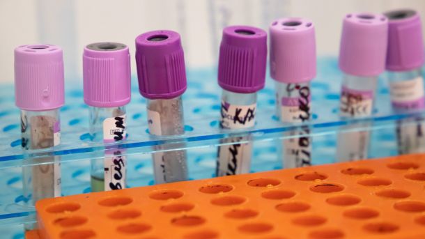 Лабораторні пробірки з аналізами крові для діагностики грипу та ГРВІ у медичній лабораторії Києва