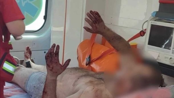 Рятувальники 32-ї ДПРЧ гасять пожежу в приватному будинку в селі Ситняки Бучанського району, де загинула одна людина